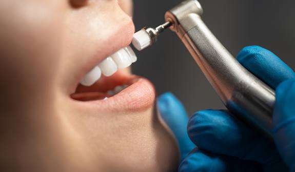 Dental professional performing teeth cleaning